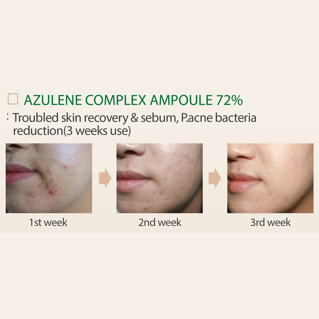 Histolab Azulene Complex Ampoule 72% – 80ml