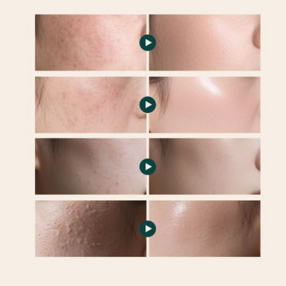 REJUALL Advanced PDRN Repair Cream 20g