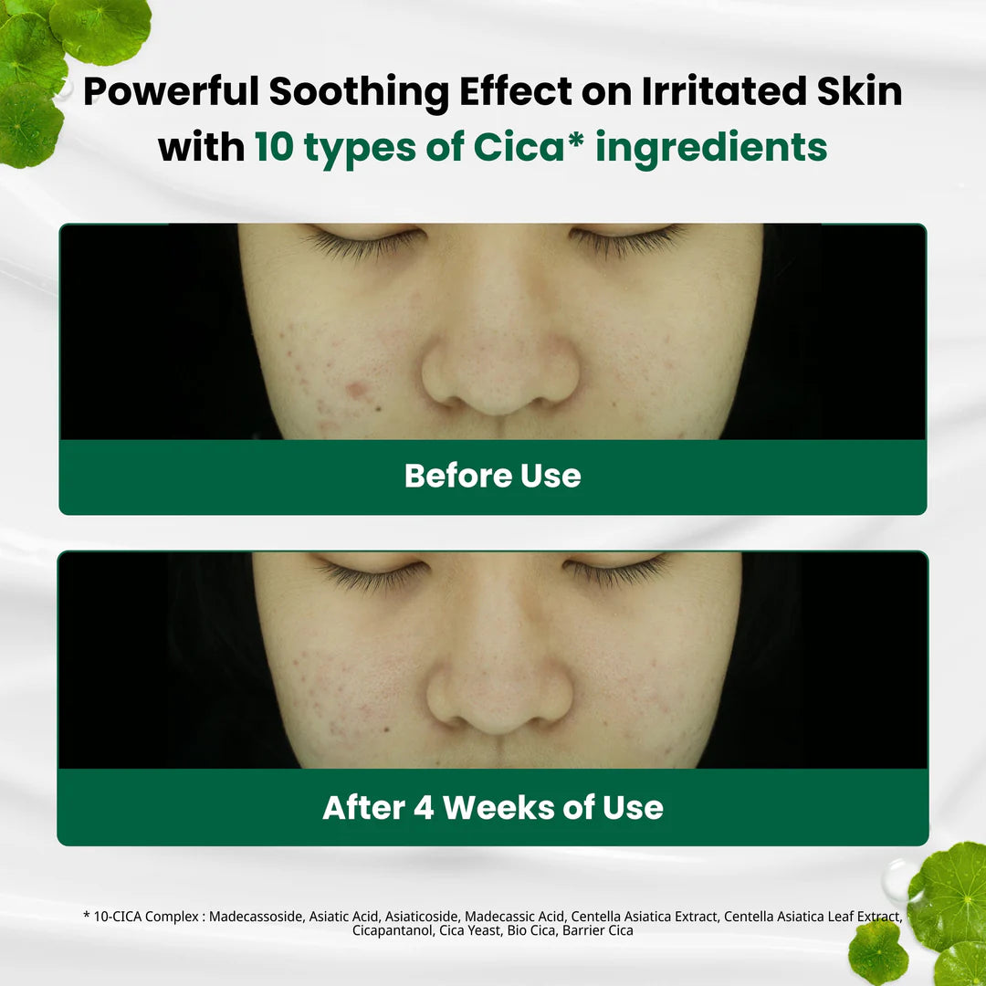 DR.G R.E.D BLEMISH CLEAR SOOTHING CREAM (70ML)