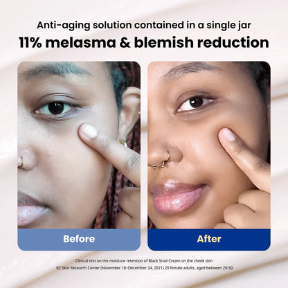 DR.G BLACK SNAIL CREAM