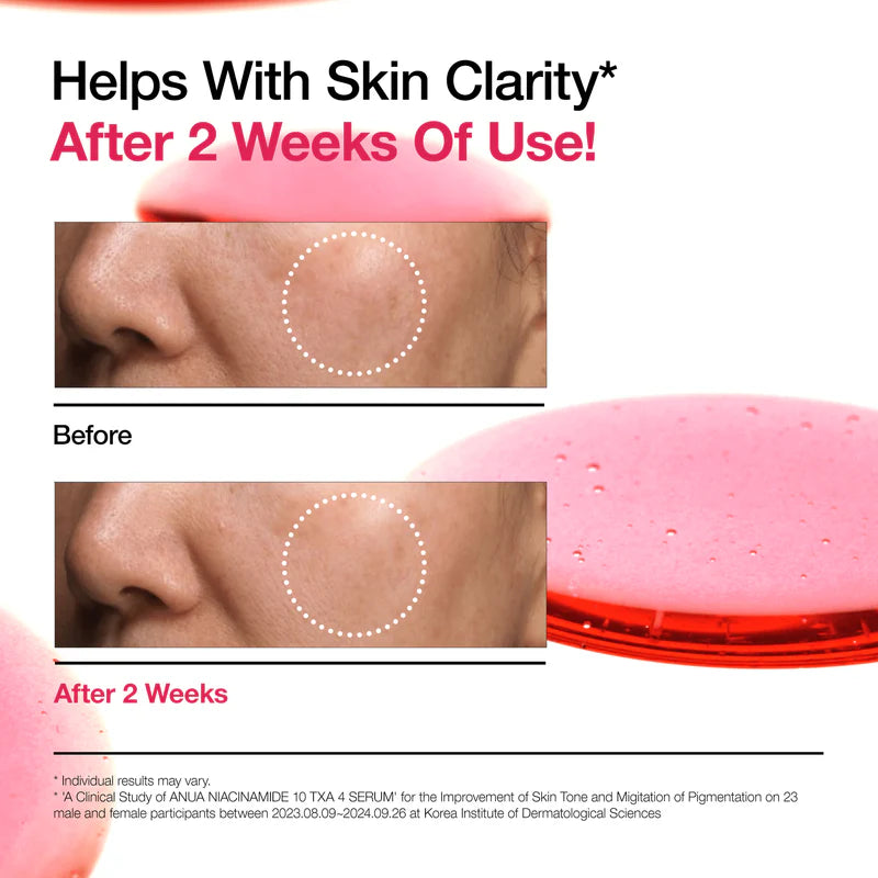 Anua NIACINAMIDE 10%+TXA 4% Serum 30ml