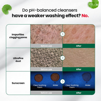 DR.G PH CLEANSING R.E.D BLEMISH CLEAR SOOTHING FOAM (150ML)