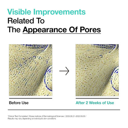 Anua BHA 2% Gentle Exfoliating Toner 150ML