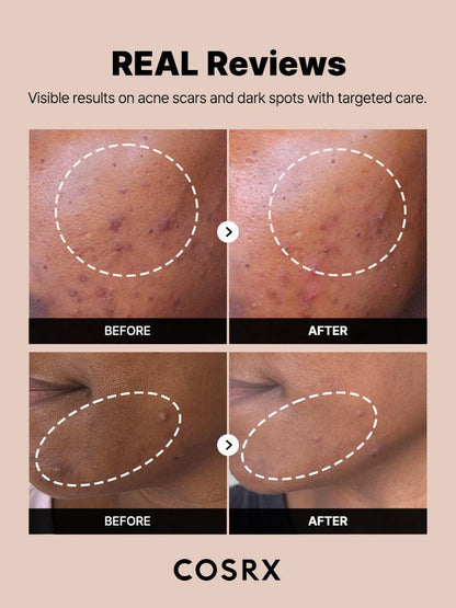 COSRX The Alpha-Arbutin 2 Discoloration Care Serum