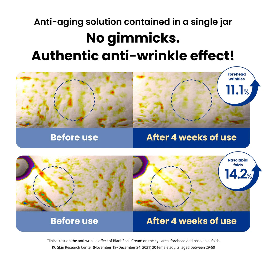 DR.G BLACK SNAIL CREAM