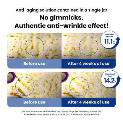 DR.G BLACK SNAIL CREAM