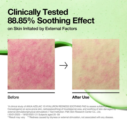 Anua Azelaic 10 Hyaluron Redness Soothing