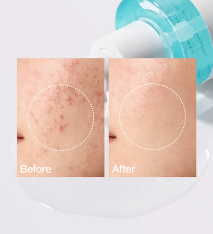 Anua BHA 2% Gentle Exfoliating Toner 150ML